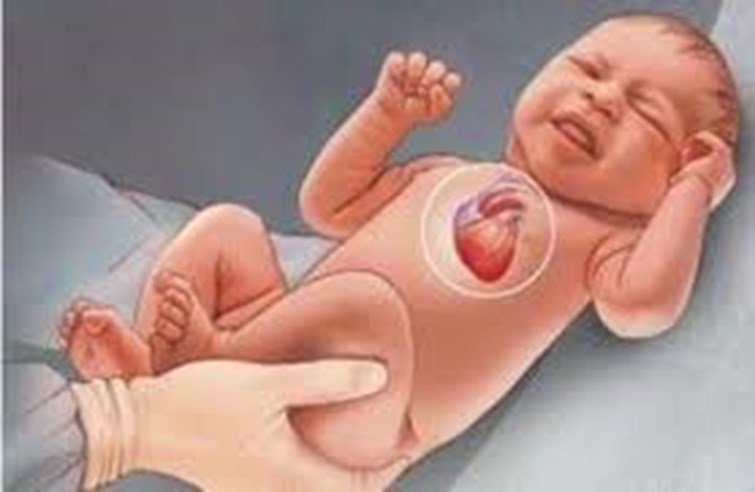 CHILD HEART