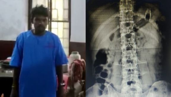 gopalganj me ek kaidi ne nigal liya dawa ki sisi 