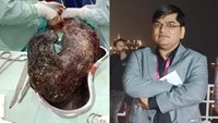 During the operation, a bunch of hair started coming out from the girl's stomach.