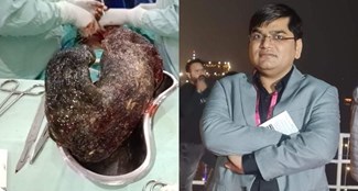 During the operation, a bunch of hair started coming out from the girl's stomach.