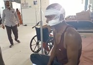 Palamu snatching with knife, laborer suffered serious injuries on head and face