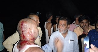  Firing on MP Ramkripal Yadav in Chenari, Masodhi, MP narrowly escaped, FIR registered against 9 people