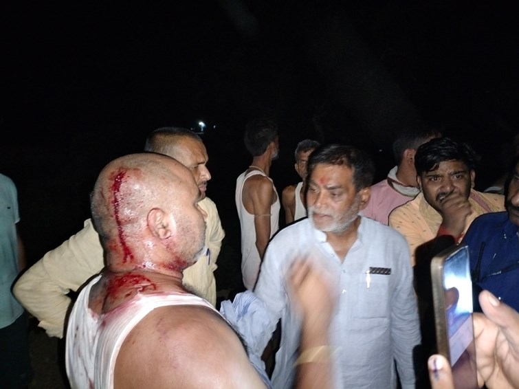  Firing on MP Ramkripal Yadav in Chenari, Masodhi, MP narrowly escaped, FIR registered against 9 people