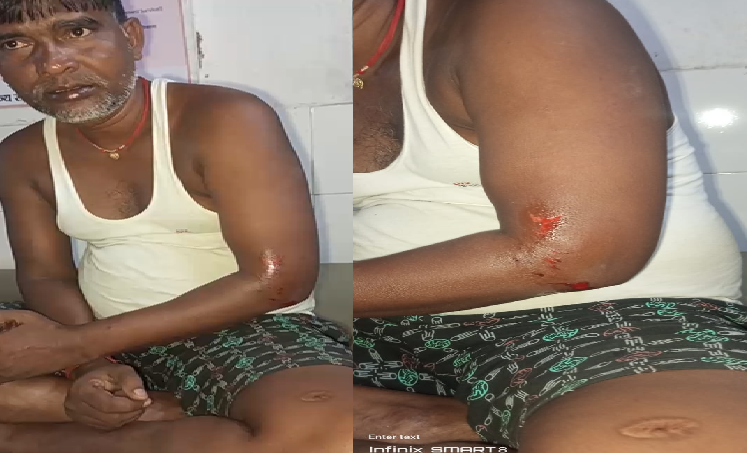 50 people attacked a Mahadalit family, injuring four people, including two men.