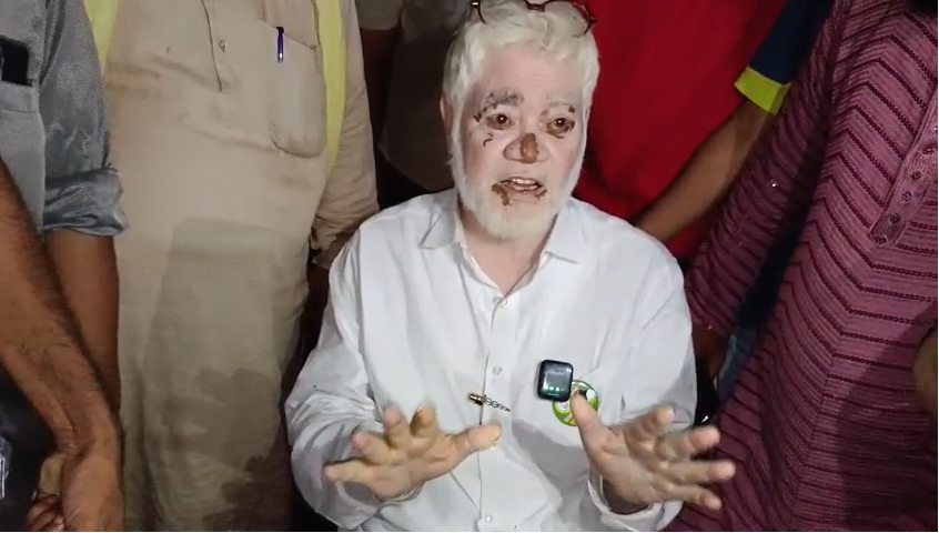 Attack on women workers of independent candidate Avnish Kumar