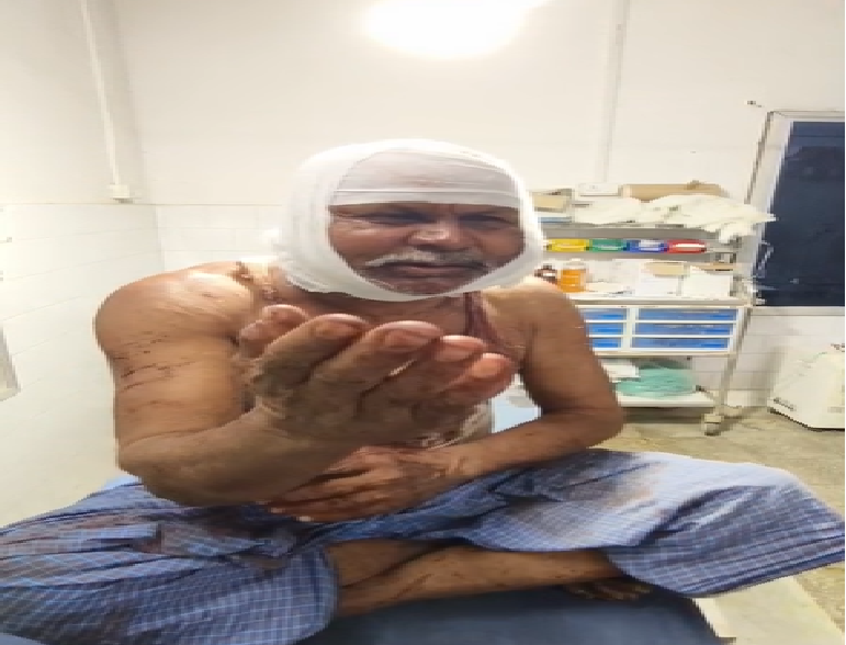 In the craze of becoming a film hero, the son made a fatal attack on his father, the father narrowly escaped.